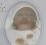 burned-baby2.jpg